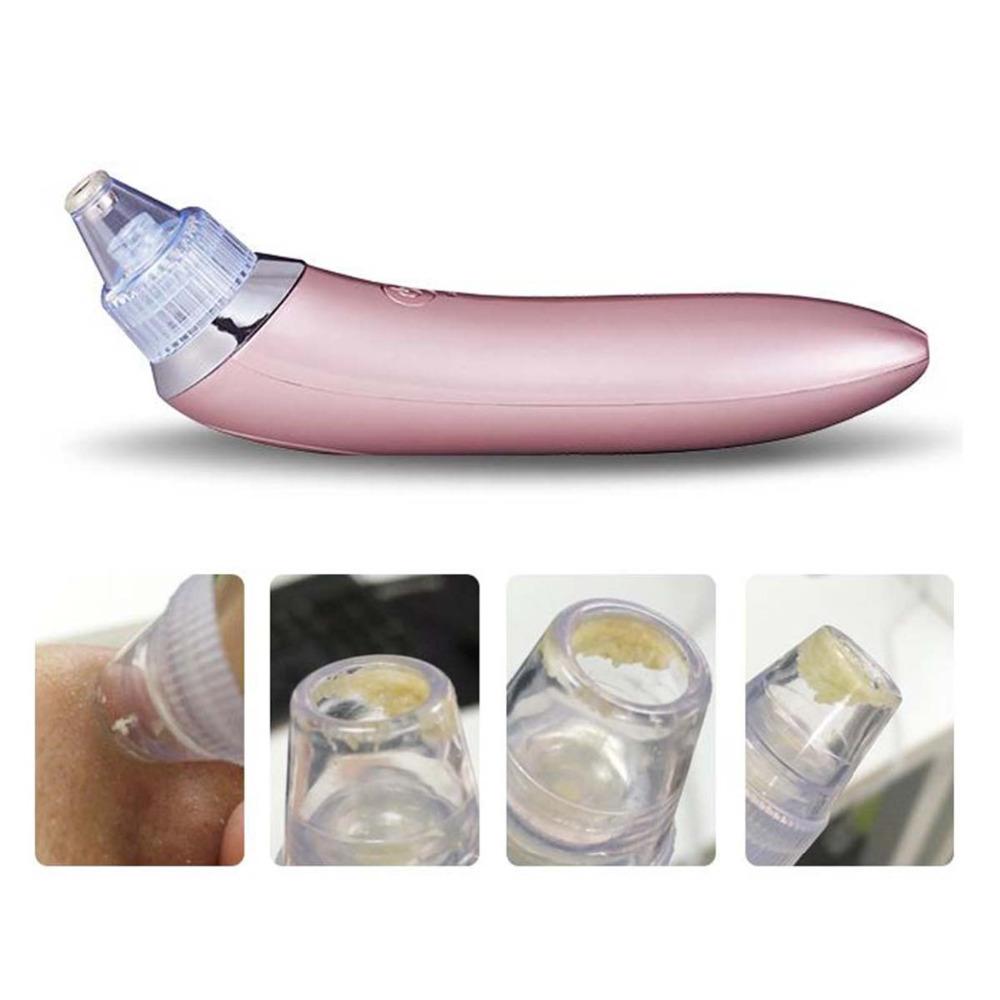 Face Pore Cleaner Blackhead Remover Vacuum Facial Cleaning Beauty Machine - Image 4